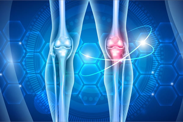 Arthritic Pain
