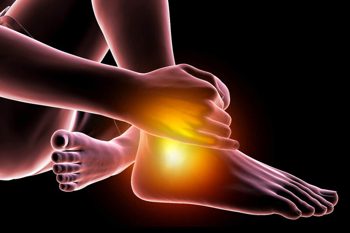 Arthrosis